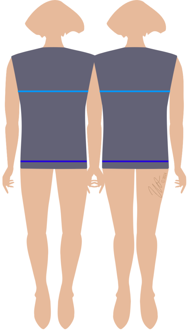 Grafik zu Figurtyp2 mit O- und X-Beinen.